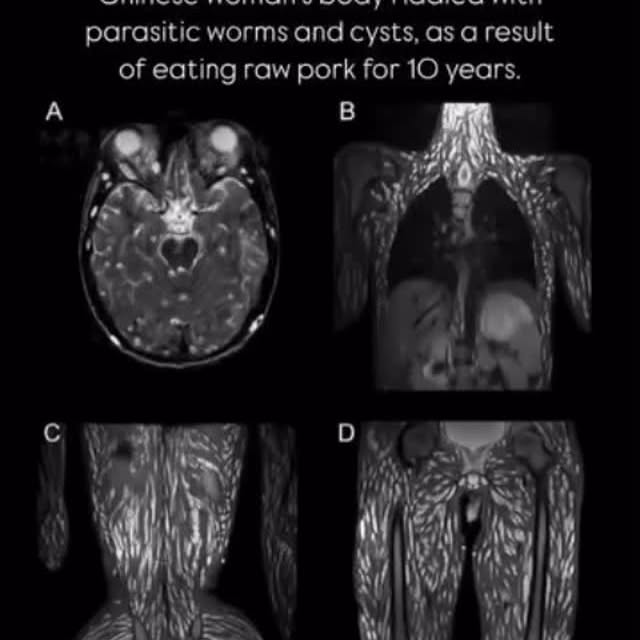  ......asedly   'recent posts' 