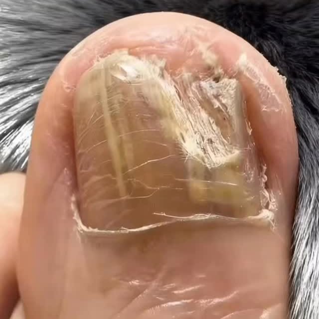  .......ehacks1   'recent posts' 