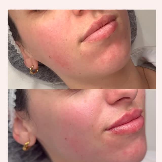  ....esro   'recent posts' 