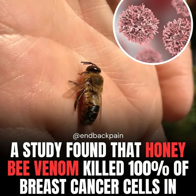  .....ckpain   'recent posts' 