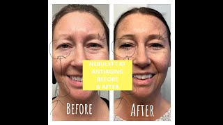  ........pot Blog  'recent videos' 