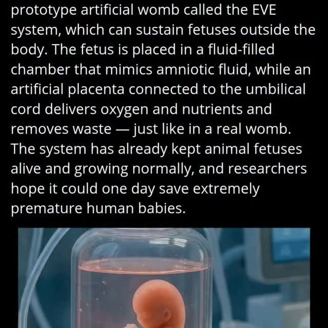  .....ckpain   'recent posts' 